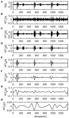 Fetal Heart Sounds Detection Using Wavelet Transform and Fractal Dimension